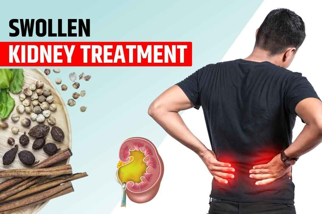 Swollen Kidney Treatment